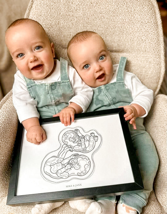 Birthline ultrasound illustration, twins