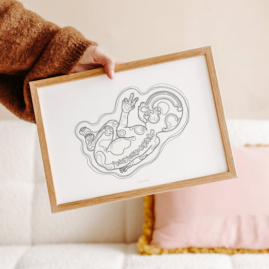 Birthline ultrasound illustration, singleton