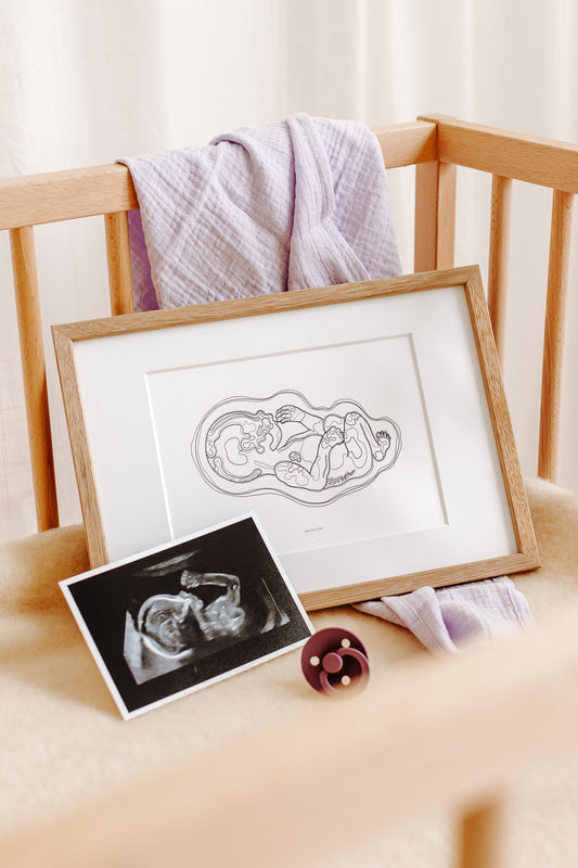 Birthline ultrasound illustration, singleton