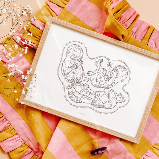 Birthline ultrasound illustration, triplets