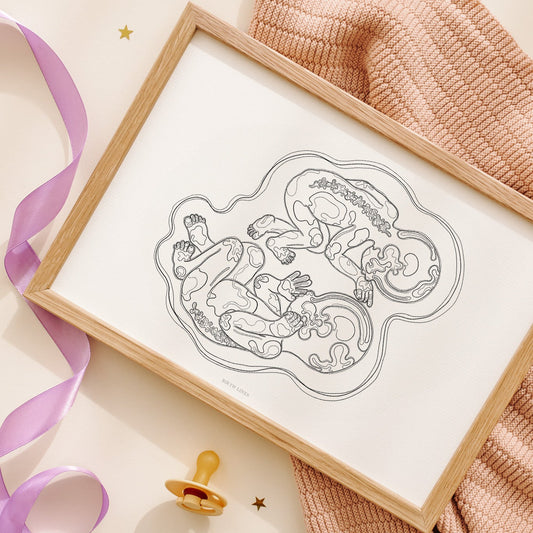 Birthline ultrasound illustration, twins