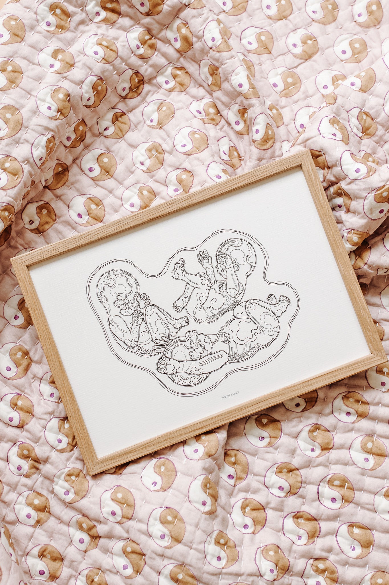 Birthline ultrasound illustration, triplets