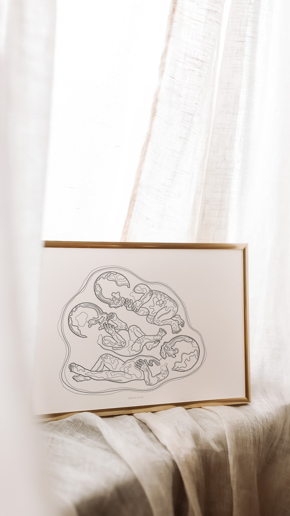Birthline ultrasound illustration, triplets