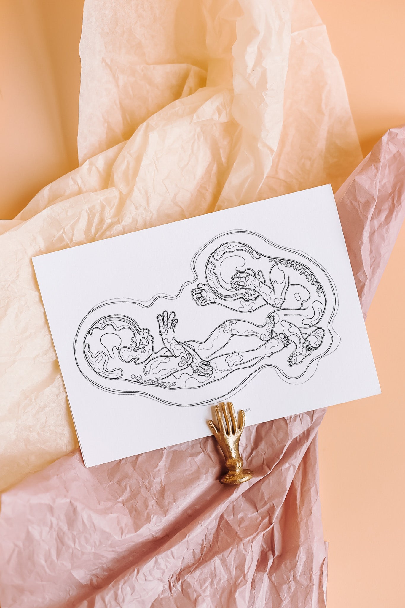 Birth Line echo-illustratie, tweeling