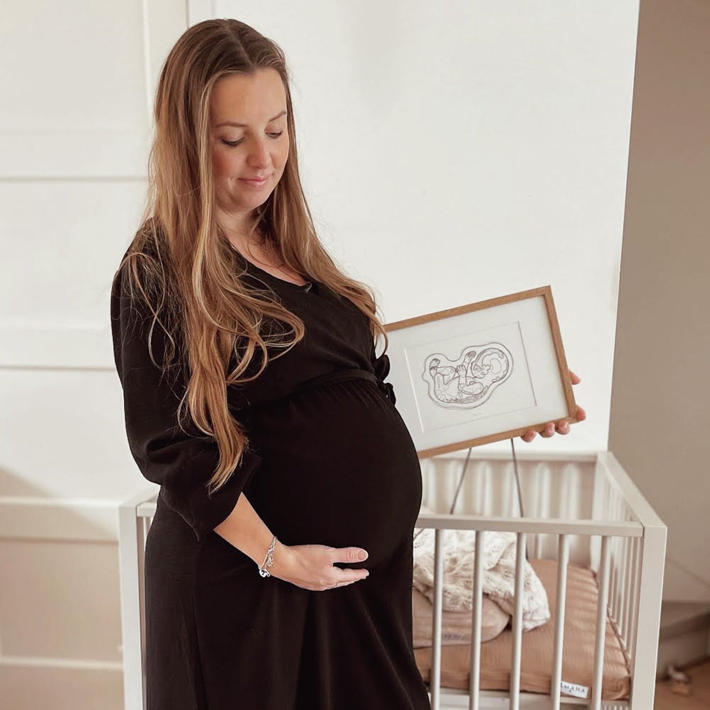 Birth Line echo-illustratie, eenling